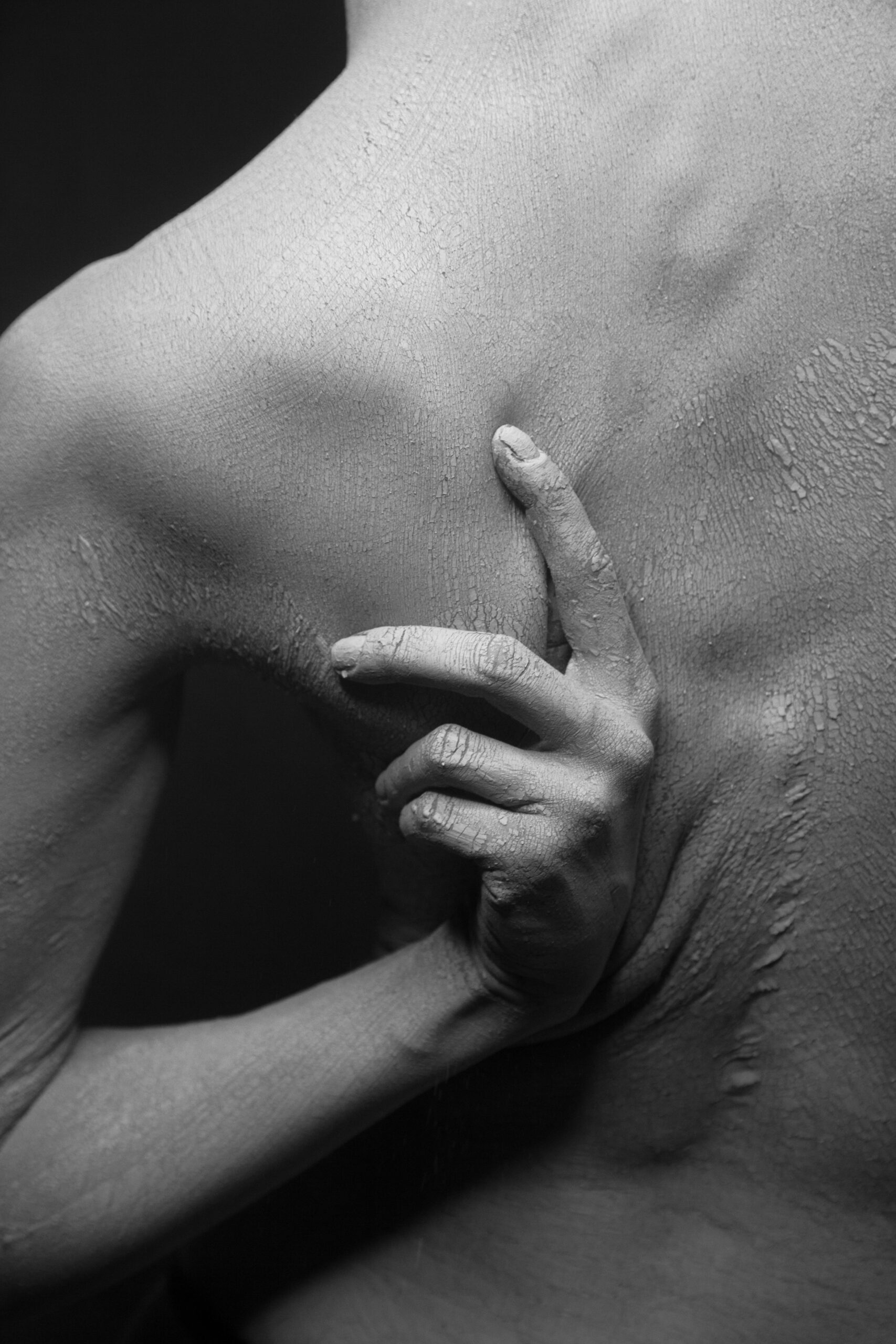 Detailed close-up of dry, flaky skin in a monochrome image, emphasizing texture and touch.