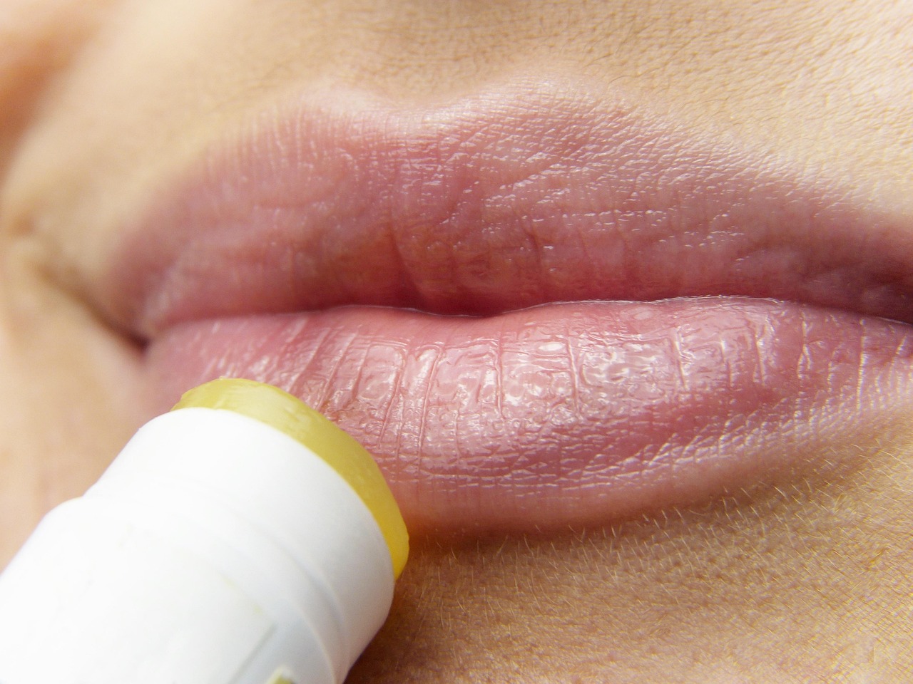 lips, lip care, lipstick, lip balm, homemade, bio, shea butter, jojoba oil, essential oils, tender, teen, naturally, grooming, cosmetics, beauty, soft, skin, sensitive, uv - radiation, sunlight, herpes, pain, medicine, woman, adults, beautiful skin, dermatology, female, care products, beeswax, coconut oil, fine skin texture, beauty care, femininity, allergy, skin irritation, lips, lips, lips, lips, lips, lip balm, lip balm, lip balm, herpes, herpes